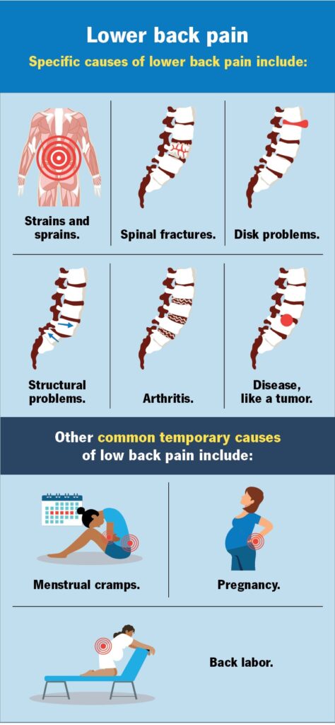 Low Back Pain Treatment in Bahadurpura, Hyderabad