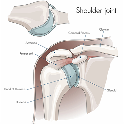 Reverse Shoulder Replacement in Bahadurpura, Hyderabad